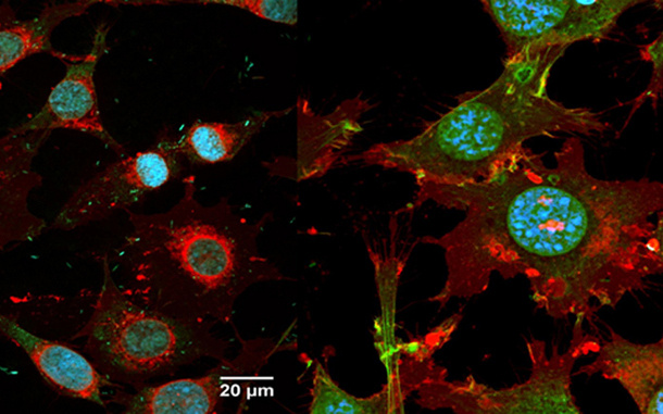 Zellen ohne antibakterielle Ausrüstung; rechts: Zellen mit antibakterieller Ausrüstung. (Foto: Förch/MPI-P)